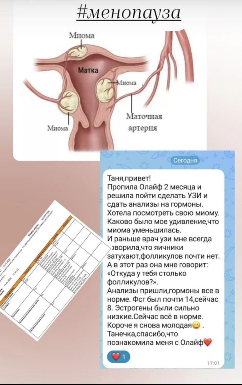 уменьшение миомы и нормализация гормонов